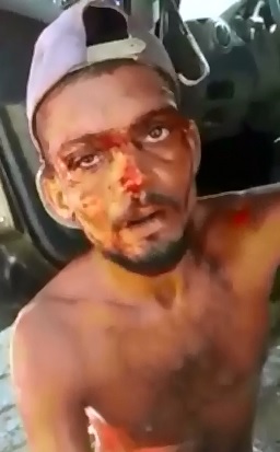 This Man was Dragged a Ways on his Motorcycle 