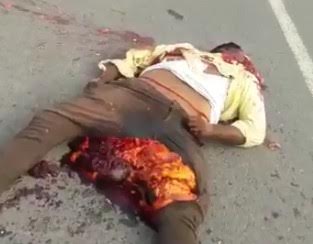 What a Human Body Looks Like when His Guts are Pushed Out through His Anus 