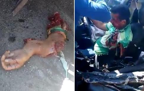 Arrival on Scene of Man stuck inside his Car with his Arm Ripped Off