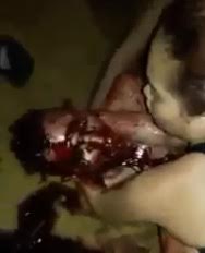 Woman refuses to leave her VERY Bloodied Dying Husband