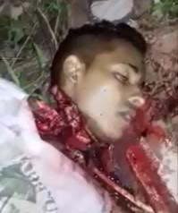 Young Kid found with his Head nearly Dangling in the Woods