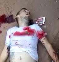 Man gives his Final Breaths after taking a Head Shot 