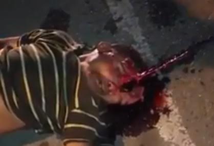 Shock Gore..Man with Head Half Opened after Fatal Accident 