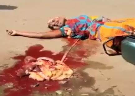 Woman Horribly Crushed with Heart still Beating (New)