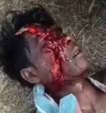 Drunk man Terribly Disfigured in accident waits for help