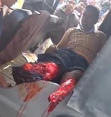 Man with feet ripped off by train waits help on the backseat