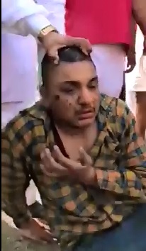 Nasty Woman Rubs Shit in the Face of 2 Accused Thieves 