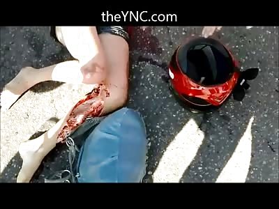 Pretty Teen Girl is in a World of Hell after Motorcycle Fall ...Holds onto her Mother 