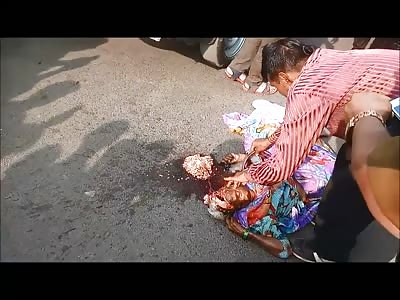 Just Gruesome Video of Elderly Lady with Her Brain Lying right Next to Her 