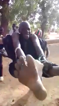 Victim of jungle justice in Africa - torture