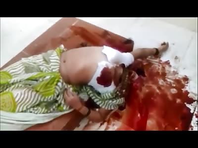 Dog Ate the Face off of a Woman in a Hospital....Wtf 