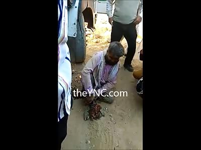 Indian Man with Crushed Feet just Wants someone to listen to Him 