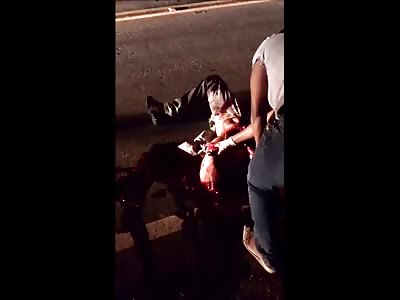 Which Way is Up?  legs Ripped Off after Accident..Still Alive 