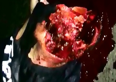 Absolute Gore that you may Nver Forget..these Faces are Ripped Open, and Some Heads are Down the Road 