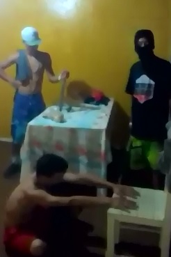 Kid has Fingers Broken like Toothpicks Over and Over Again.  Punished in Brazilian favela : They Broke His Fingers .