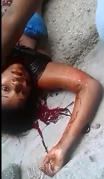 I don't think there is any Hope. Woman Stabbed by her Ex-Bf takes her Last Breath 