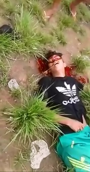 Dying Man makes Noises only a Dying Man would Make...The Death Grumble 