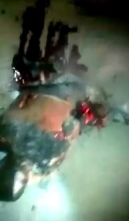 Whoops..the Dynamite he was Carrying in his Backpack Exploded while he was Playing around with It