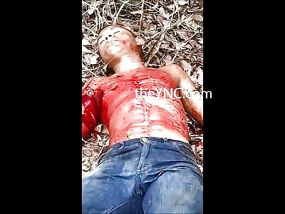 Kid Shot in the Chest Spurts Blood Everywhere 