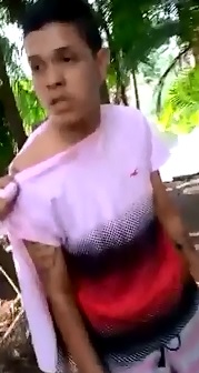 Boy is Shot through Both Hands for Stealing in the Wrong Neighborhood 