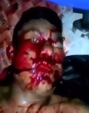 Up Close Camera Video shows Man's Gruesome Last Signs of Life 