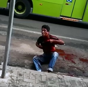 Man Shot in the Death Flips like a Fish out of Water 