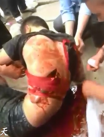 Cut Wide Open with a Machete...Man Holds on for Life 