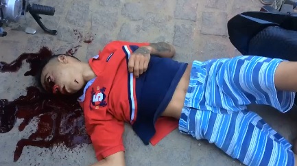 Better Angle of Young Boy Dying from Gunshot Wound