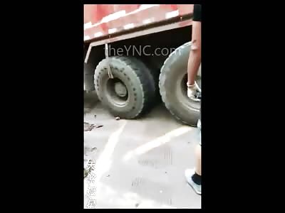 Boy with Floppy Foot after being Hit by a Truck 