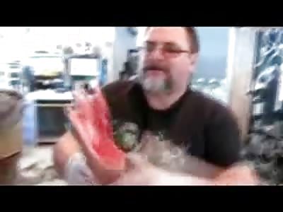 I'm Donald Carlson and This Is My Foot