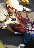 Everyone Seems to Need That Must Have Photo of Brains on her Head