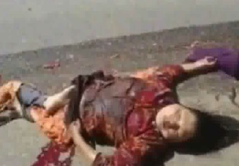 Woman Left Mangled and Fucked up From Accident