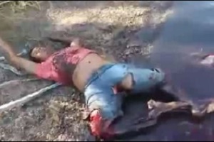 Agonizing Man Can only Move His Right Arm.... Buddies Mangled