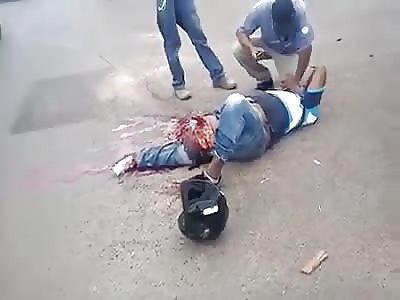 Arm and Leg Twisted Up