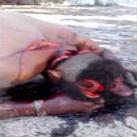 Dude Hacked Up by Machete is a MESS 