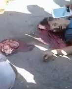 Dudes Brain Squeezed Out of His Head While Everyone Snaps a Selfie