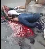 Picking up the Pieces ... Womans Head Splatterd by Truck