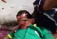 Man Cries Holding his Dead Brother Who's Face is Melting Off