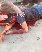 Dude Bleeds and Agonizes After Being Shot