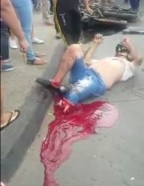 Leg Turned into Just a Pool of Blood