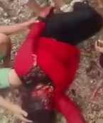 FUCKED UP: Woman Disfigured by Husband