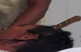 Man has a Knife Stuck in the Head