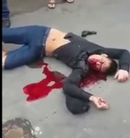 Thief Vomits Blood after Being Shot by Police