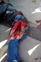 Leg Fucked up showing Tendons and Muscles of the Leg 