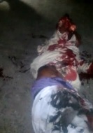 Man in Agony with his Arm Ripped off by Train