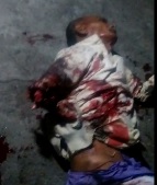 Better Quality of Dude with Arm Ripped Off