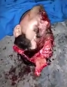 Head is Cracked Open Oozing Brain