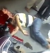 Man with head crushed and his brain like a pizza on the road