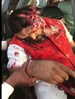 No Need to Check His Pulse