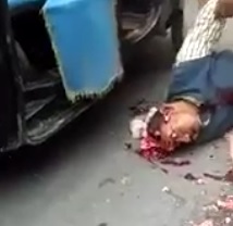 Brains Splatter Out of Head when They Pick Him Up